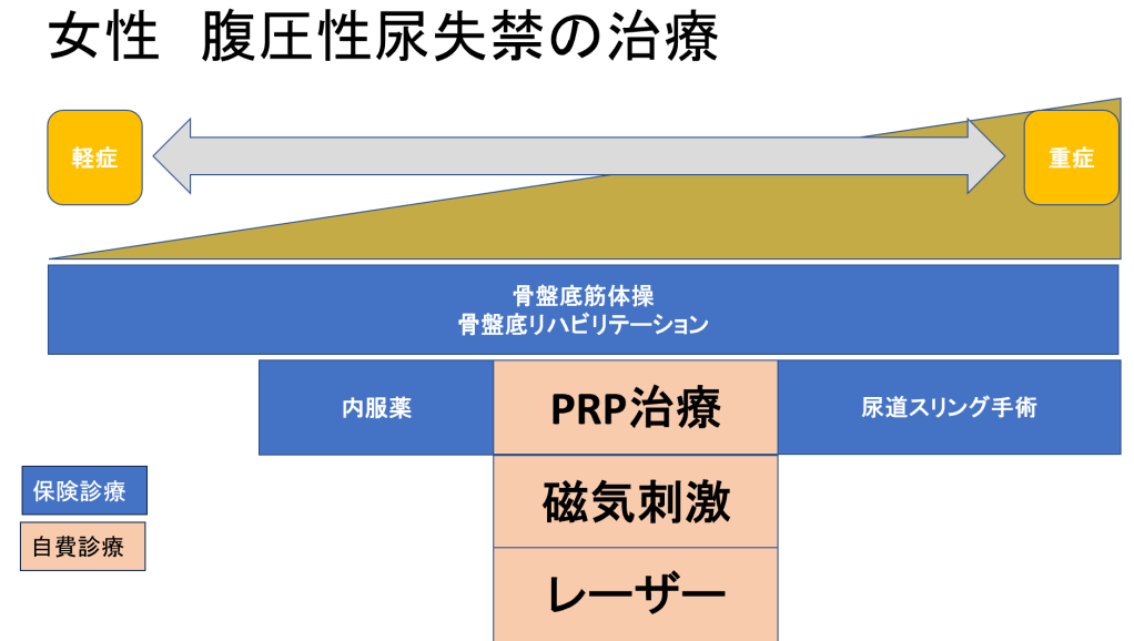 女性の腹圧性尿失禁の治療法を示す図。軽症から重症までの治療オプションを階層的に整理している。
