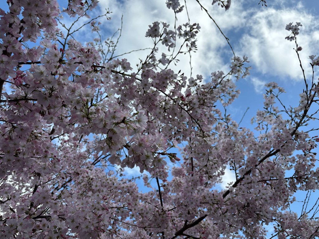 腰背部痛=腎臓?と思ったら要注意