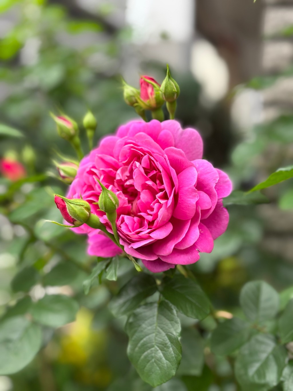 Hematuria with Unknown Cause? It Might Be the&nbsp;Prostate